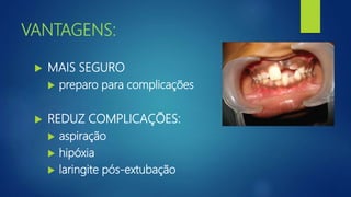 VANTAGENS:
 MAIS SEGURO
 preparo para complicações
 REDUZ COMPLICAÇÕES:
 aspiração
 hipóxia
 laringite pós-extubação
 