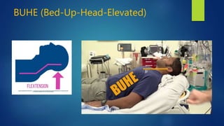 BUHE (Bed-Up-Head-Elevated)
 