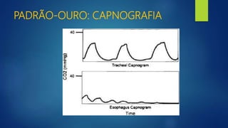 PADRÃO-OURO: CAPNOGRAFIA
 