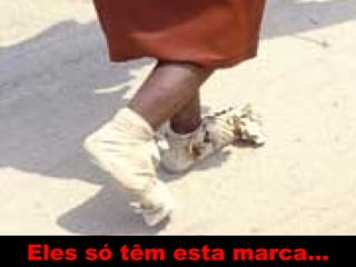 Eles só têm esta marca… 