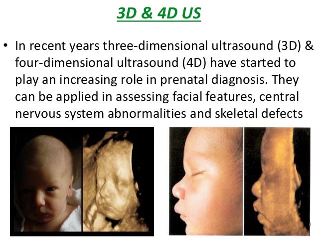 3D & 4D US  â¢ In recent years three-dimensional ultrasound (3D) &  four-dimensional ultrasound (4D) have started to  play ...