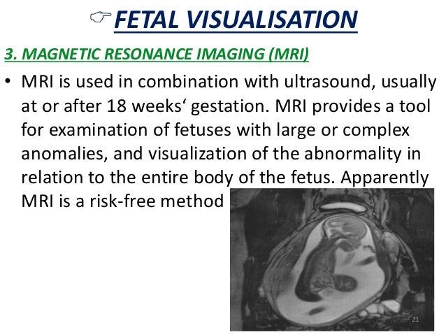 ïFETAL VISUALISATION  3. MAGNETIC RESONANCE IMAGING (MRI)  â¢ MRI is used in combination with ultrasound, usually  at or af...