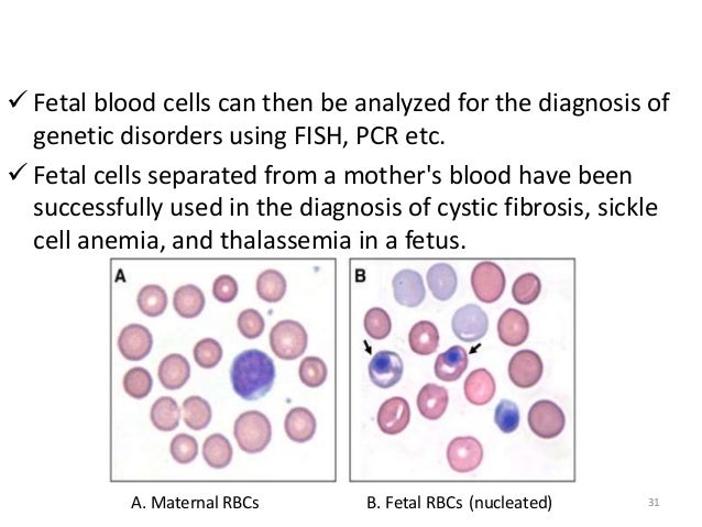ï¼ Fetal blood cells can then be analyzed for the diagnosis of  genetic disorders using FISH, PCR etc.  ï¼ Fetal cells separ...