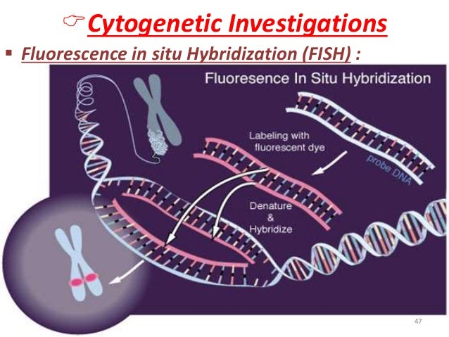 ïCytogenetic Investigations  ï§ Fluorescence in situ Hybridization (FISH) :  47   