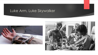Luke Arm, Luke Skywalker
 