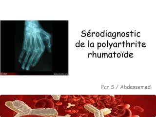 Sérodiagnostic 
de la polyarthrite 
rhumatoïde 
Par S / Abdessemed 
Abdsalah 
 