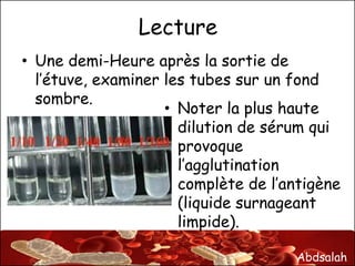 Abdsalah
Lecture
• Une demi-Heure après la sortie de
l’étuve, examiner les tubes sur un fond
sombre.
• Noter la plus haute
dilution de sérum qui
provoque
l’agglutination
complète de l’antigène
(liquide surnageant
limpide).
 
