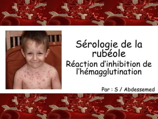 S/A 
SérologRie de la 
rubéole 
Réaction d’inhibition de 
l’hémagglutination 
Par : S / Abdessemed 
 