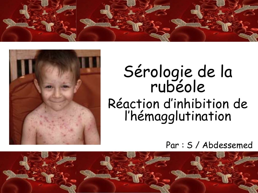 Sérologie de la rubéole