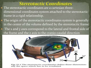 Stereotactic Radiosurgery/ Radiotherapy | PPTX
