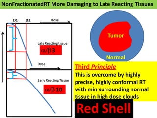 Tumor
Normal
Third Principle
This is overcome by highly
precise, highly conformal RT
with min surrounding normal
tissue in high dose clouds
Red Shell
NonFractionatedRT More Damaging to Late Reacting Tissues
 