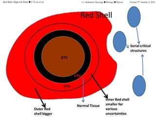CTV
PTV
Normal Tissue
Red Shell
Serial critical
structures
GTV
Inner Redshell
smaller for
various
uncertainties
Outer Red
shell bigger
 