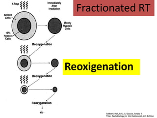 Reoxigenation
Authors: Hall, Eric J.; Giaccia, Amato J.
Title: Radiobiology for the Radiologist, 6th Edition
Fractionated RT
 