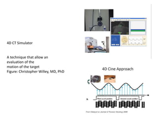 4D CT Simulator
A technique that allow an
evaluation of the
motion of the target
Figure: Christopher Willey, MD, PhD
 