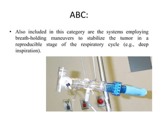 ABC:
• Also included in this category are the systems employing
breath-holding maneuvers to stabilize the tumor in a
reproducible stage of the respiratory cycle (e.g., deep
inspiration).
 