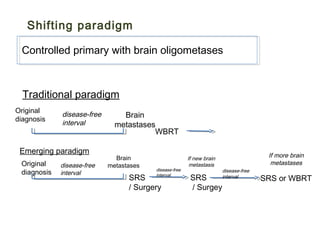 Shifting paradigm
Controlled primary with brain oligometases
Original
diagnosis
disease-free
interval
Brain
metastases
WBRT
Traditional paradigm
Original
diagnosis
disease-free
interval
Brain
metastases
SRS
/ Surgery
Emerging paradigm
disease-free
interval
If new brain
metastasis
SRS
/ Surgey
disease-free
interval
If more brain
metastases
SRS or WBRT
 