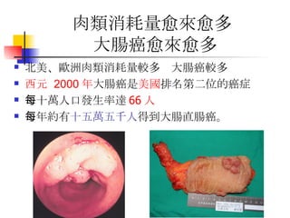 肉類消耗量愈來愈多  大腸癌愈來愈多 北美、歐洲肉類消耗量較多  大腸癌較多 西元  2000 年 大腸癌是 美國 排名第二位的癌症 每十萬人口發生率達 66 人 每年約有 十五萬五千人 得到大腸直腸癌。 