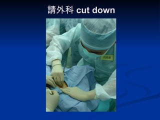 請外科 cut down 