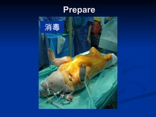 Prepare  消毒 