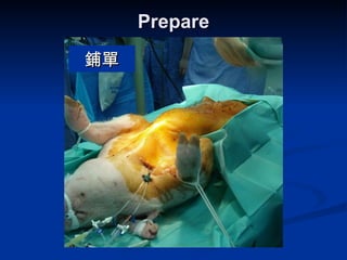 Prepare  鋪單 
