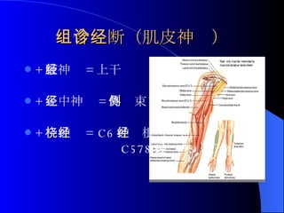 组合诊断（肌皮神经） + 腋神经 = 上干 + 正中神经 = 外侧束 + 桡神经 = C6 神经根（全部） C578 神经根（部分） 