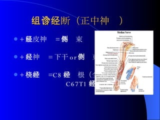 组合诊断（正中神经） + 肌皮神经 = 外侧束 + 尺神经 = 下干 or 内侧束 + 桡神经 =C8 神经根（全部） C67T1 神经根（部分） 