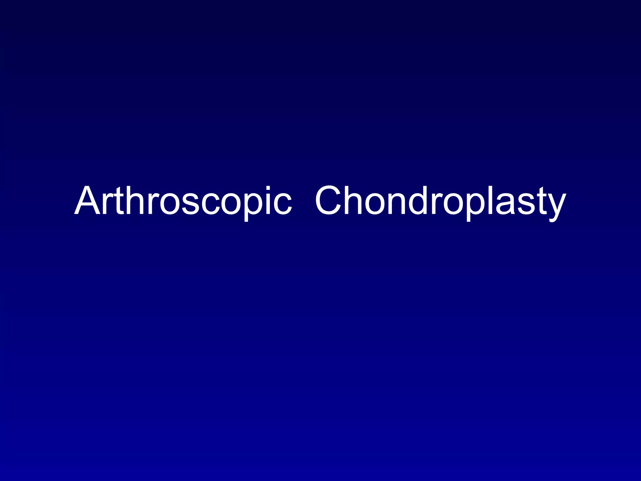 Arthroscopic  Chondroplasty 