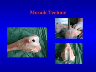 Mosaik Technic 