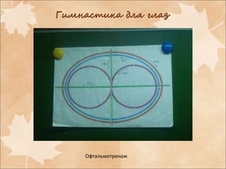 Офтальмотренаж