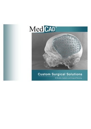 MedCAD - Custom Implants and Surgical Solutions