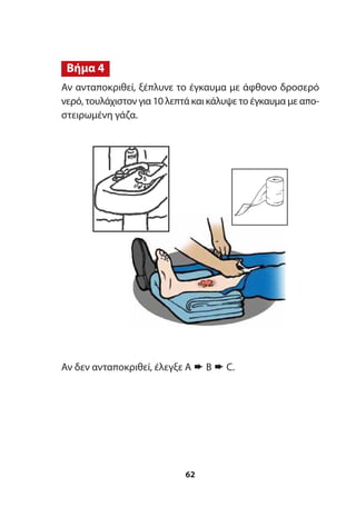 Αν ανταποκριθεί, ξέπλυνε το έγκαυμα με άφθονο δροσερό
νερό, τουλάχιστον για 10 λεπτά και κάλυψε το έγκαυμα με απο-
στειρωμένη γάζα.
Βήμα 4
62
Αν δεν ανταποκριθεί, έλεγξε A ➨ B ➨ C.
 