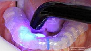 23 10,13 All Rights Reserved.© 3M
3M Marketing
Clinical photography courtesy of
Dr Esfandiar Modjahedpour, Germany
 