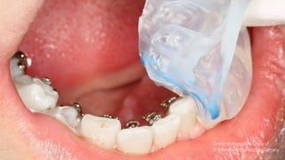 25 10,13 All Rights Reserved.© 3M
3M Marketing
 