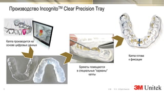 9 10,13 All Rights Reserved.© 3M
3M Marketing
Производство IncognitoTM Clear Precision Tray
Каппа готова
к фиксации
Брекеты помещаются
в специальные "карманы"
каппы
Каппа производится на
основе цифровых данных
 
