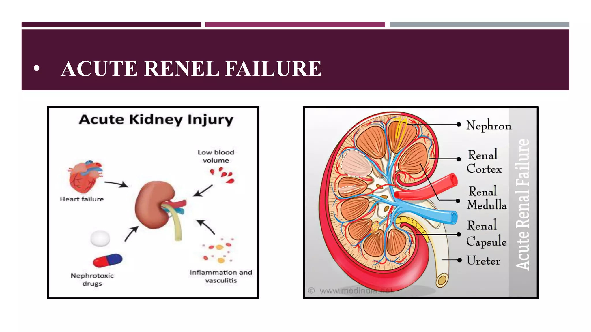 Kidney Diseases | PDF | Lung and Respiratory Health | Diseases and ...