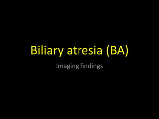 Biliary atresia (BA)
Imaging findings
 