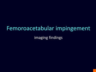 Femoroacetabular impingement
imaging findings
 