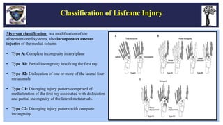 Fractures and Dislocations of Foot - Dr Sunkappa SR | PPTX