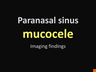 Paranasal sinus
mucocele
Imaging findings
 