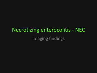 Necrotizing enterocolitis - NEC
Imaging findings
 
