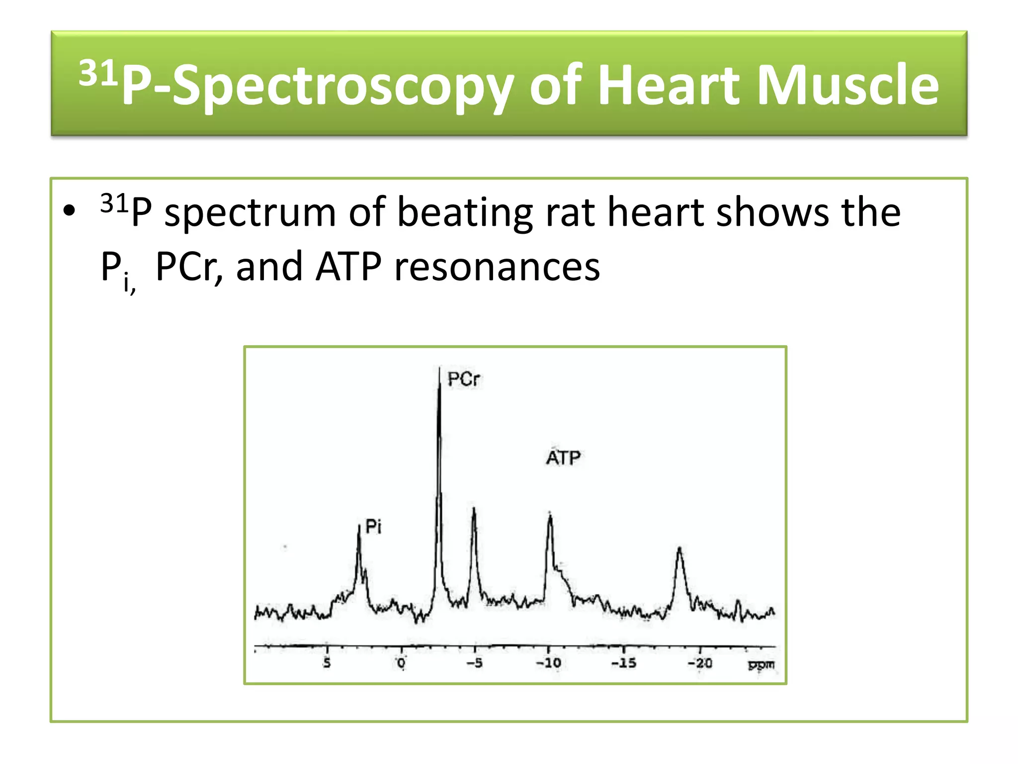 31P-Spectroscopy of Heart Muscle 
• 31P spectrum of beating rat heart shows the 
Pi, PCr, and ATP resonances 
 