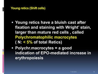 Young retics (Shift cells)



 Young retics have a bluish cast after
  fixation and staining with Wright’ stain,
  larger than mature red cells , called
  Polychromatophilic macrocytes
  ( N: < 5% of total Retics)
 Polychr.macrocytes = a good
  indication of EPO-mediated increase in
  erythropoiesis


                               7/18/2011      16
 