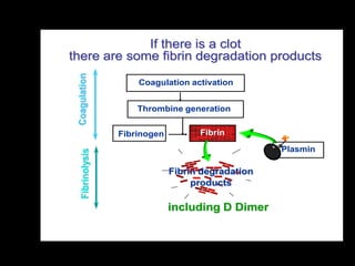 If there is a clot
there are some fibrin degradation products

 Coagulation           Coagulation activation


                       Thrombine generation


                   Fibrinogen         Fibrin

                                                     Plasmin
    Fibrinolysis




                                Fibrin degradation
                                     products

                                including D Dimer
 