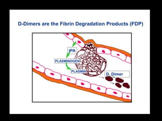 D-Dimers are the Fibrin Degradation Products (FDP)




                    tPA

              PLASMINOGEN


                     PLASMIN
                                   D. Dimer
 