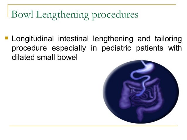 Short Bowel Syndrome (SBS), Short Gut Syndrome