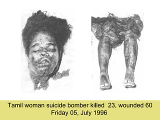 Tamil woman suicide bomber killed 23, wounded 60
             Friday 05, July 1996
 