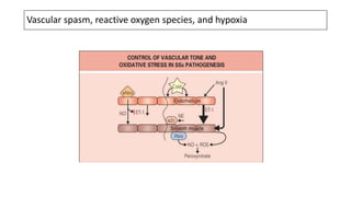 Vascular spasm, reactive oxygen species, and hypoxia
 