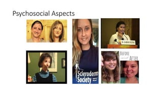 Psychosocial Aspects
 