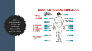 Score
assessment of
skin by the
modified
Rodnan skin
scoring system
 