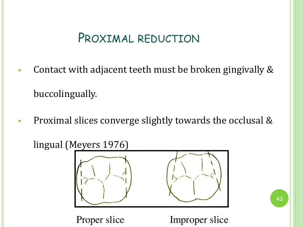 Stainless steel crowns in Pediatric Dentistry